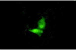 Figure:FITC staining on IHC-P;Simple: A549 cells (IRF6 antibody  (AA 196-445))