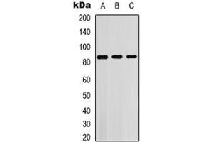 Western blot analysis of SGK1/2 (pT256/253) expression in HEK293T (A), Jurkat (B), NIH3T3 (C) whole cell lysates. (SGK1/2 (pSer253), (pSer256) antibody)