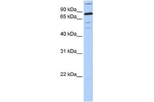 Human 721_B; WB Suggested Anti-ZNF700 Antibody Titration: 0. (ZNF700 antibody  (C-Term))