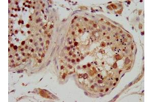 IHC image of ABIN7150380 diluted at 1:600 and staining in paraffin-embedded human testis tissue performed on a Leica BondTM system.