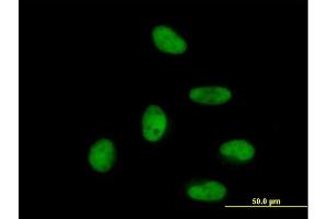 Immunofluorescence of purified MaxPab antibody to ZNF496 on HeLa cell. (ZNF496 antibody  (AA 1-587))