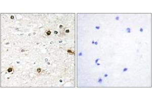 Immunohistochemistry analysis of paraffin-embedded human brain tissue, using NAB2 Antibody. (NAB2 antibody  (AA 261-310))