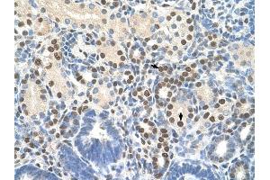 ZNF326 antibody was used for immunohistochemistry at a concentration of 4-8 ug/ml to stain Epithelial cells of renal tubule (arrows) in Human Kidney. (ZNF326 antibody  (C-Term))