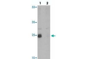 Western blot analysis of NKX2-8 in rat liver tissue with NKX2-8 polyclonal antibody  at 1 ug/mL in (lane 1) the absence and (lane 2) the presence of blocking peptide. (NKX2-8 antibody  (Internal Region))