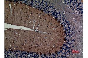 Immunohistochemistry (IHC) analysis of paraffin-embedded Rat Brain, antibody was diluted at 1:100. (NEFL antibody  (C-Term))