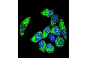 Confocal immunofluorescent analysis of WT1 Antibody (Center ) (ABIN655904 and ABIN2845304) with MCF-7 cell followed by Alexa Fluor® 488-conjugated goat anti-rabbit lgG (green). (WT1 antibody  (AA 346-375))