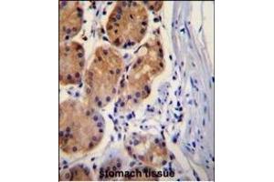 CTNB1 Antibody (C-term) (ABIN655178 and ABIN2844795) immunohistochemistry analysis in formalin fixed and paraffin embedded human stomach tissue followed by peroxidase conjugation of the secondary antibody and DAB staining.