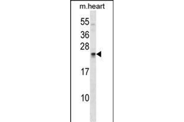 SOSTDC1 antibody  (C-Term)