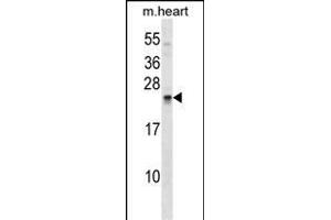 SOSTDC1 Antibody (C-term) (ABIN1536776 and ABIN2849017) western blot analysis in mouse heart tissue lysates (35 μg/lane).
