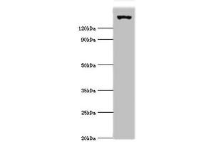 Western blot All lanes: EIF2AK4 antibody at 2 μg/mL + Mouse lung tissue Secondary Goat polyclonal to rabbit IgG at 1/10000 dilution Predicted band size: 187, 184, 70 kDa Observed band size: 187 kDa