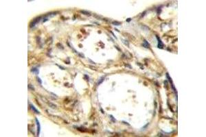 DLK antibody immunohistochemistry analysis in formalin fixed and paraffin embedded human placenta tissue. (MAP3K12 antibody)