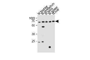 Western blot analysis in mouse bladder,cerebellum,testis,spleen and liver tissue lysates (35ug/lane). (ZNF654 antibody  (C-Term))