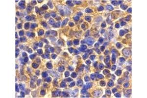 Immunohistochemistry of UBC13 in mouse thymus tissue with UBC13 antibody at 2 μg/ml. (UBE2N antibody  (C-Term))