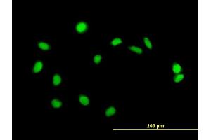 Immunofluorescence of purified MaxPab antibody to ZBED1 on HeLa cell. (ZBED1 antibody  (AA 1-694))