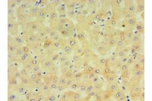 Immunohistochemistry of paraffin-embedded human liver tissue using ABIN7149272 at dilution of 1:100 (CYP4F12 antibody  (AA 265-524))