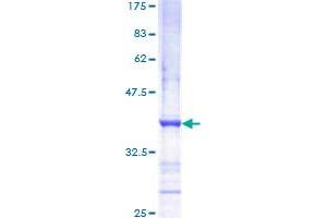 Image no. 1 for Met Proto-Oncogene (MET) (AA 26-125) protein (GST tag) (ABIN1310735)