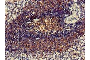 Immunohistochemistry of paraffin-embedded human spleen tissue using ABIN7158646 at dilution of 1:100 (BC055111 antibody  (AA 1-418))