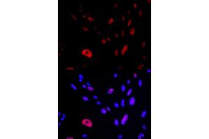 Immunofluorescence (IF) image for anti-HUS1 Checkpoint Homolog (S. Pombe) (HUS1) antibody (ABIN1876595) (HUS1 antibody)