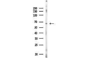 anti-Acyl-CoA Synthetase Short-Chain Family Member 1 (ACSS1) antibody