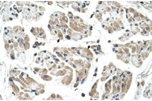 Immunohistochemical staining (Formalin-fixed paraffin-embedded sections) of human muscle with CHST1 polyclonal antibody  at 4-8 ug/mL working concentration.