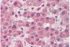 Human Liver (formalin-fixed, paraffin-embedded) stained with PC antibody ABIN337183 at 5 ug/ml followed by biotinylated anti-goat IgG secondary antibody ABIN481715, alkaline phosphatase-streptavidin and chromogen. (PC antibody  (AA 886-899))