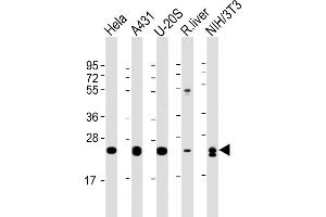 All lanes : Anti-RAB1B Antibody at 1:4000 dilution Lane 1: Hela whole cell lysate Lane 2: A431 whole cell lysate Lane 3: U-20S whole cell lysate Lane 4: rat liver lysate Lane 5: NIH/3T3 whole cell lysate Lysates/proteins at 20 μg per lane. (RAB1B antibody  (AA 1-201))