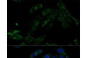 Immunofluorescence analysis of C6 cells using ATP6V0C Polyclonal Antibody at dilution of 1:100 (40x lens). (ATP6V0C antibody)