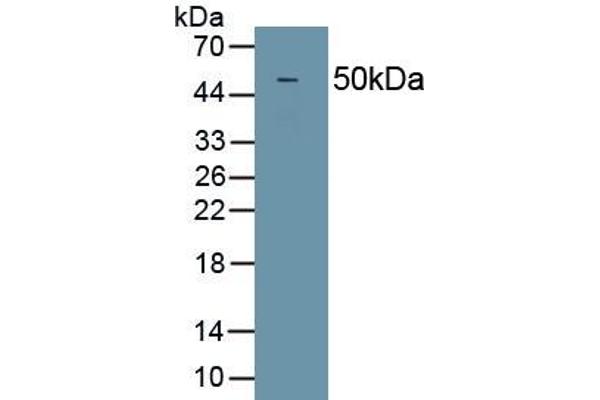 DMBT1 Antikörper  (AA 2008-2413)