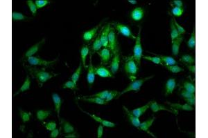 Immunofluorescence staining of Hela cells with ABIN7159933 at 1:100, counter-stained with DAPI. (LETM1 antibody  (AA 443-543))