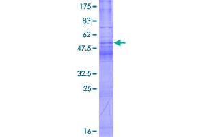 Image no. 1 for Tetraspanin 1 (TSPAN1) (AA 1-241) protein (GST tag) (ABIN1323923) (TSPAN1 Protein (AA 1-241) (GST tag))