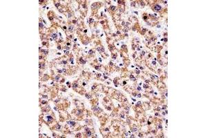 Immunohistochemistry analysis in formalin fixed and paraffin embedded human liver tissue reacted with HYAL1 / Hyaluronidase-1 Antibody (C-term) followed by peroxidase conjugation of the secondary antibody and DAB staining. (HYAL1 antibody  (C-Term))