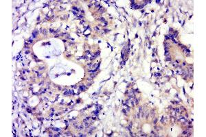 Paraformaldehyde-fixed, paraffin embedded human cervical carcinoma, Antigen retrieval by boiling in sodium citrate buffer (pH6. (NDEL1 antibody  (pSer242))