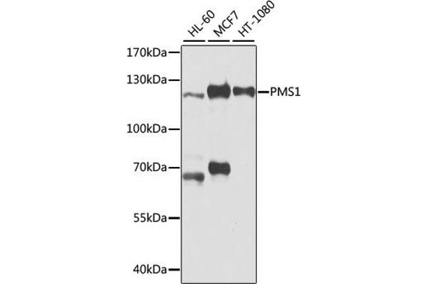 PMS1 antibody  (AA 405-619)