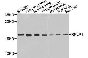 Western blot analysis of extracts of various cells, using RPLP1 antibody. (RPLP1 antibody)