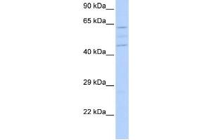 Western Blotting (WB) image for anti-Vacuolar Protein Sorting 37 Homolog A (VPS37A) antibody (ABIN2459607) (VPS37A antibody)