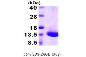 SDS-PAGE (SDS) image for Dynein, Light Chain, Tctex-Type 1 (DYNLT1) (AA 1-113) protein (His tag) (ABIN667437)