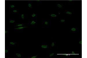 Immunofluorescence of monoclonal antibody to EGR1 on HeLa cell. (EGR1 antibody  (AA 211-320))