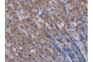 IHC-P analysis of Rat Stomach Tissue, with DAB staining. (RIPK1 antibody  (AA 1-179))