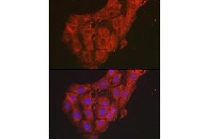 Immunofluorescence analysis of C6 cells using GRO alpha Rabbit pAb (ABIN6130150, ABIN6139267, ABIN6139268 and ABIN6221487) at dilution of 1:100 (40x lens). (CXCL1 antibody  (AA 1-107))