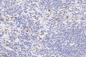 Immunohistochemistry analysis of paraffin-embedded mouse spleen using,Factor XIIIa (ABIN7073528) at dilution of 1: 2400 (F13A1 antibody)