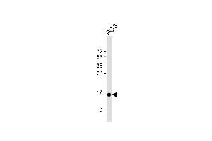 Anti-D Antibody (N-term) at 1:1000 dilution + PC-3 whole cell lysate Lysates/proteins at 20 μg per lane.