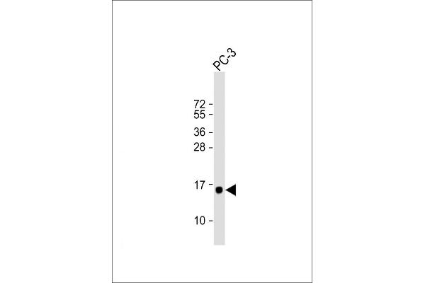 DAP anticorps  (N-Term)