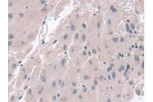 GAMT antibody  (AA 64-236)