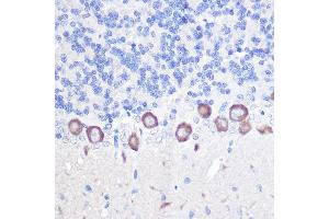 Immunohistochemistry of paraffin-embedded rat brain using PLC beta 3 (PLC beta 3 (PLCB3)) Rabbit pAb (ABIN6134972, ABIN6145749, ABIN6145750 and ABIN6214407) at dilution of 1:100 (40x lens). (PLCB3 antibody  (AA 1050-1150))