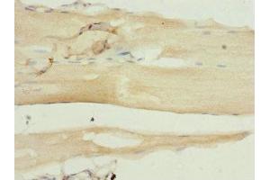Immunohistochemistry of paraffin-embedded human skeletal muscle tissue using ABIN7169457 at dilution of 1:100 (SH2B1 antibody  (AA 360-520))
