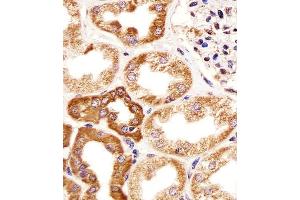 Immunohistochemical analysis of paraffin-embedded H. (CALB1 antibody  (AA 90-116))