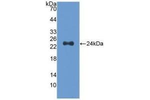 Detection of Recombinant Slit2, Human using Polyclonal Antibody to Slit Homolog 2 (Slit2) (SLIT2 antibody  (AA 1160-1333))