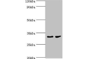 Western blot All lanes: CA8 antibody at 4 μg/mL Lane 1: Mouse skeletal muscle tissue Lane 2: Mouse liver tissue Secondary Goat polyclonal to rabbit IgG at 1/10000 dilution Predicted band size: 33 kDa Observed band size 33 kDa (CA8 antibody  (AA 1-290))
