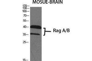 Western Blot (WB) analysis of specific cells using Rag A/B Polyclonal Antibody. (RagA/B (C-Term) antibody)