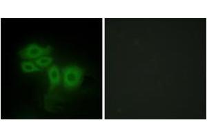 Immunofluorescence analysis of HepG2 cells, using SLK Antibody. (SLK antibody  (AA 1151-1200))